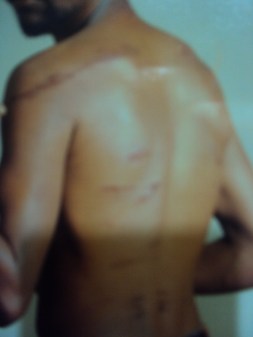 Dargaggoo Girmaa Nagaasaa, polisoota Wayyaaneen reebamee Dargaggoo Girmaa Nagaasaa, polisoota Wayyaaneen reebamee